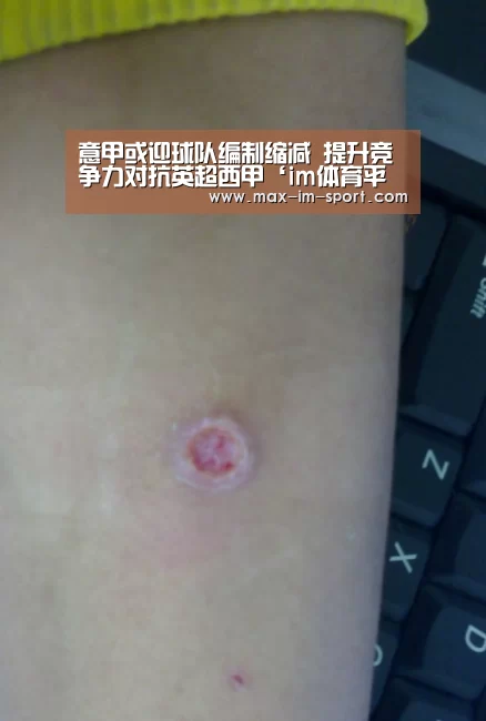 im体育下载